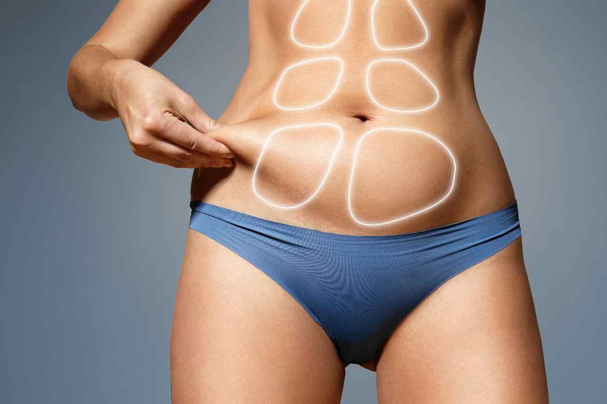 Riconoscere cellulite e ritenzione idrica 